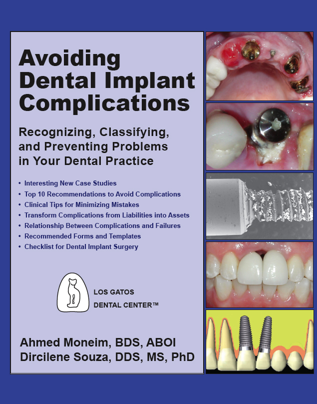 Avoiding Dental Implant Complications